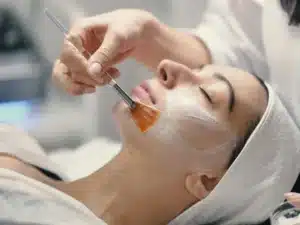 Peeling chimico viso - post trattamento